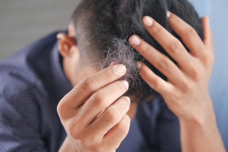 Revitalize Your Locks: The Power of Alopecia Hair Shampoo