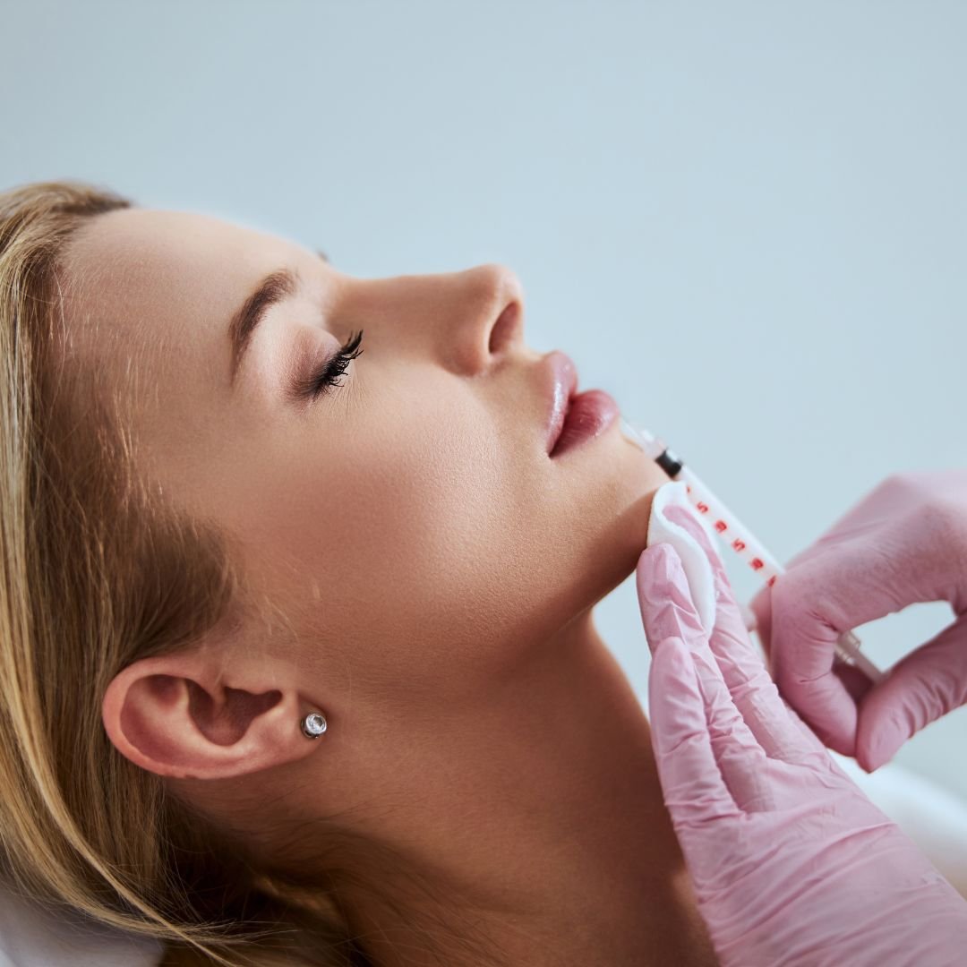 Dermal Fillers at Medical Spa